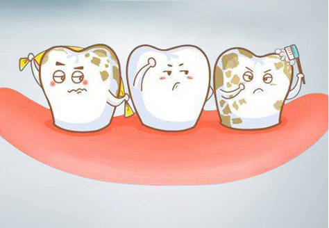 哪种修复方式比较便宜？