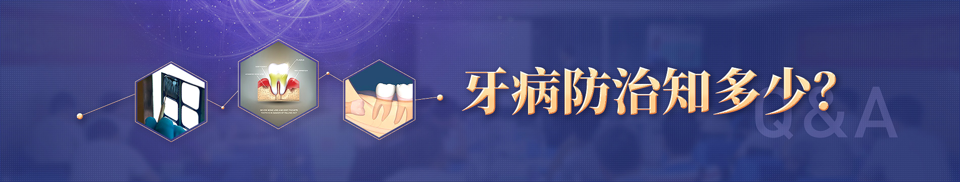 补牙